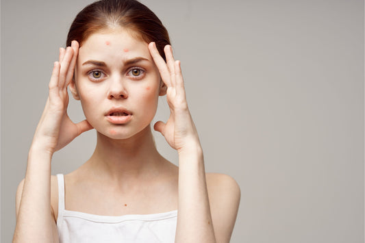 The Skincare Routine for Teens: How to Keep Your Skin Looking Fresher